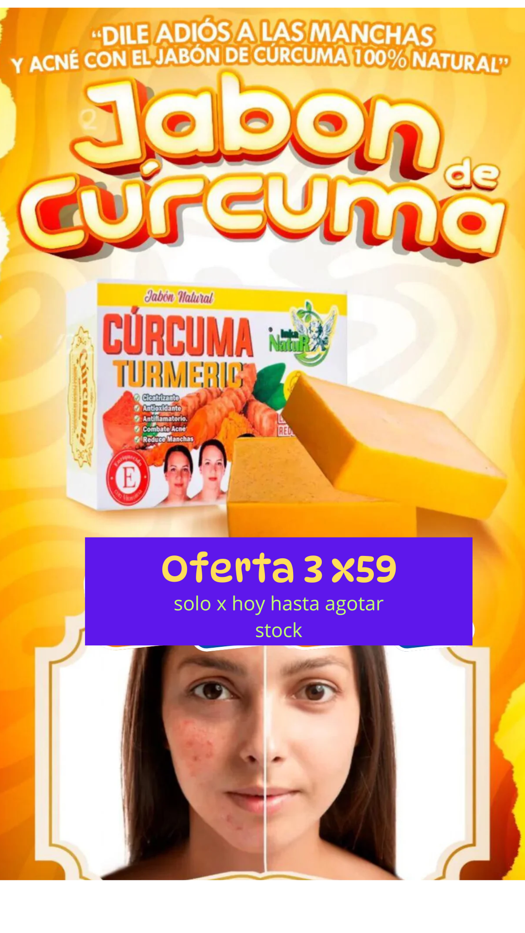 JABON DE CURCUMA